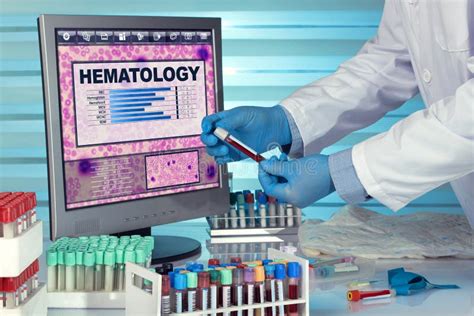 10 Ways To Succeed As A Hematology Tech