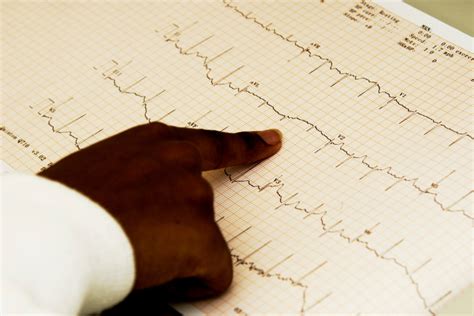 5 Key Differences: Monitor Tech Vs Ekg Tech