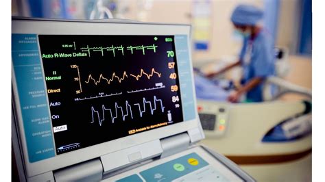 5 Reasons To Choose Ekg Tech As A Career