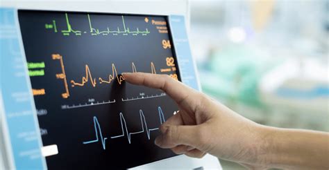 5 Top Travel Ekg Tech Agencies To Know