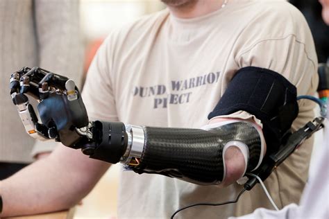 5 Ways Bio Tech Prosthetics Enhance Human Lives