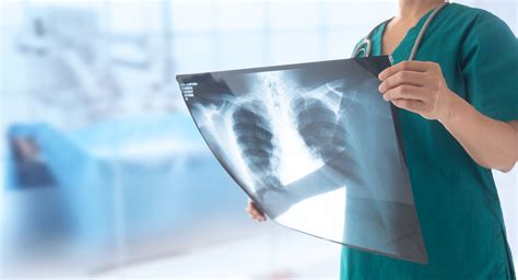 5 Ways To Become A Radiology Tech In Dallas