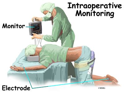 7 Ways Intraoperative Monitoring Tech Saves Lives