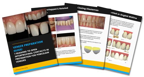 Become A Certified Veneer Technician