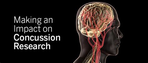 Concussion Research And Perspectives At Virginia Tech