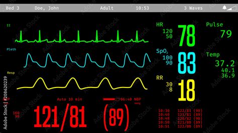 Data Tech Icu: Monitoring For A Healthy Digital Heartbeat