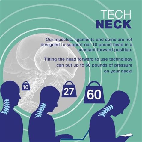 Ignoring The Pain: Unseen Symptoms Of Tech Neck