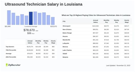 Louisiana Ultrasound Tech Salaries: Top Paying Cities Revealed