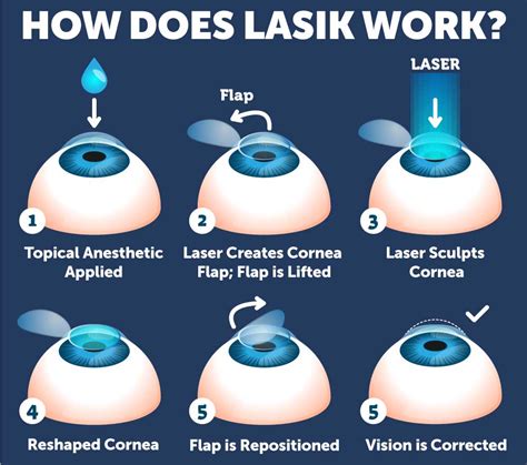 Ophthalmic Surgical Tech: A Guide To The Experts Behind Lasik