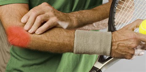 Tennis Elbow And Tech Elbow: Understanding The Difference